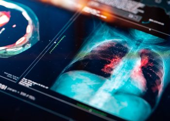 Savara: A High-Risk Opportunity